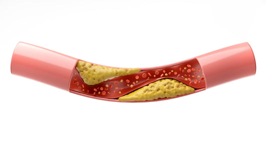 High blood pressure and blood clots: Causes and factors related to LPCVS
