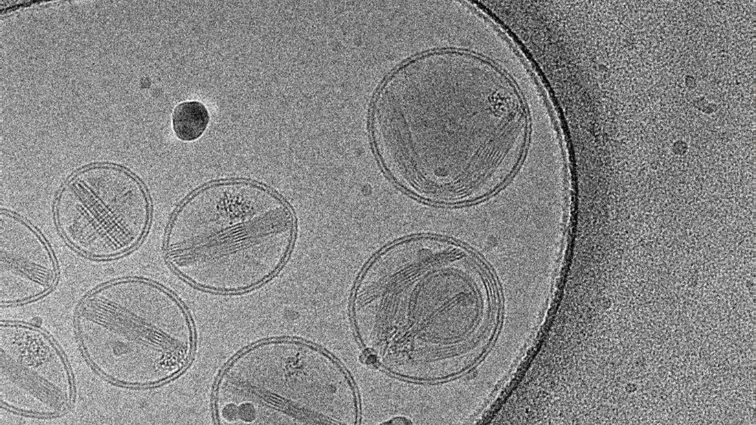 Lipid Nanoparticles and Their Link to TTS, GBS, and Spike-Associated Mechanisms