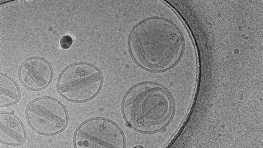 Lipid Nanoparticles and Their Link to TTS, GBS, and Spike-Associated Mechanisms